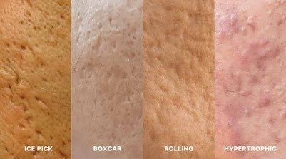 best skin, hair & laser clinic in raipur